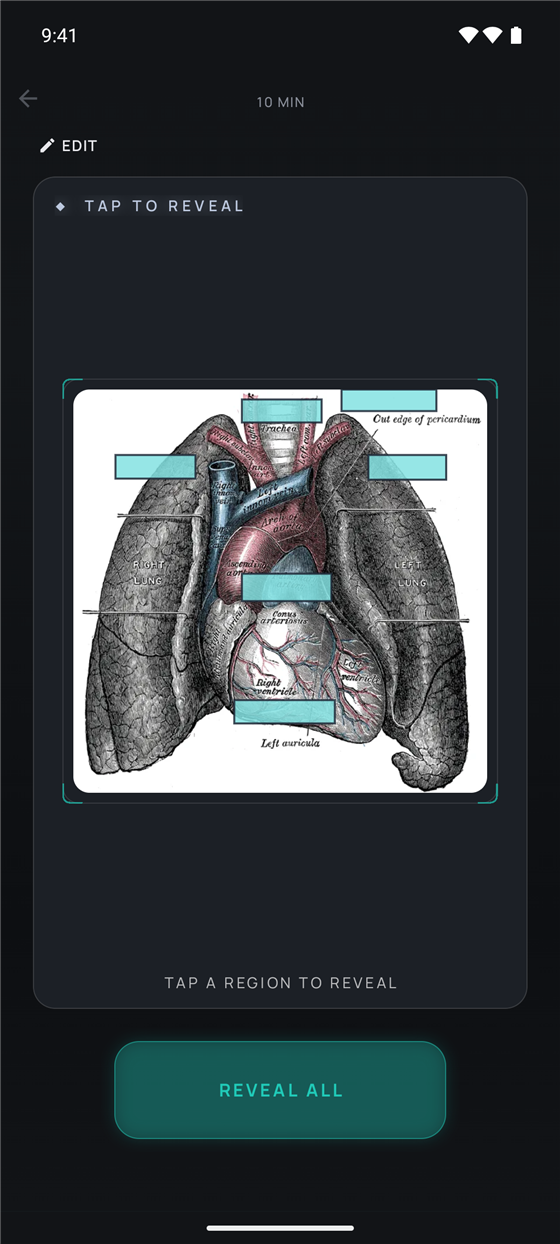 An Etch image-occlusion card in review — teal masks covering labels on a heart-and-lungs anatomy diagram, ready to tap and reveal.